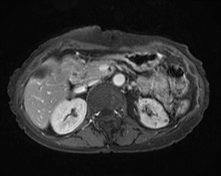 膵臓(MRCP)Dynamic ｜ Search Radiology ｜ 医療関係者向け情報