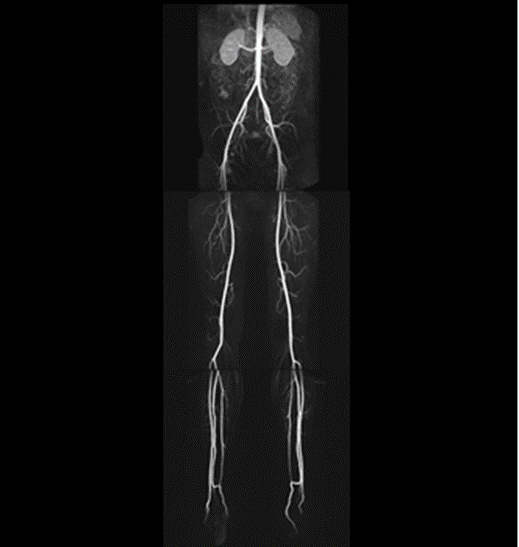 下肢造影MRA ｜ Search Radiology ｜ 医療関係者向け情報