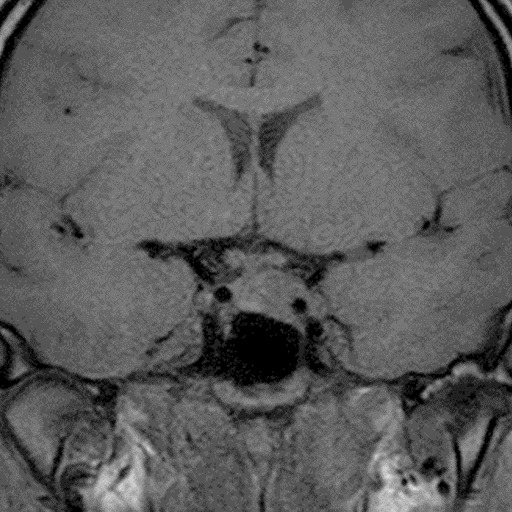 下垂体2 ｜ Search Radiology ｜ 医療関係者向け情報