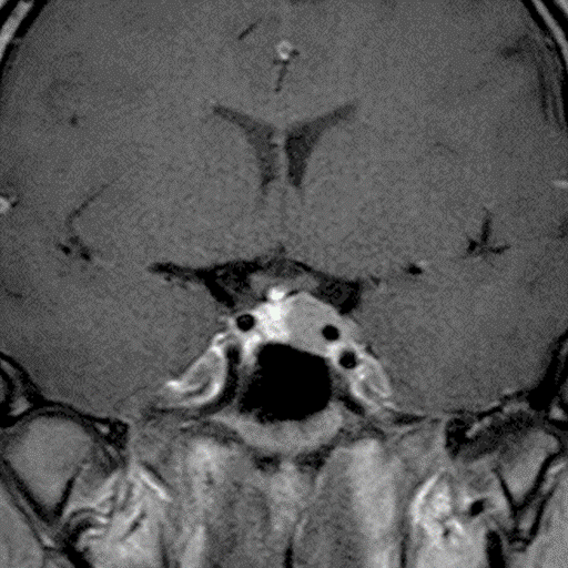 下垂体2 ｜ Search Radiology ｜ 医療関係者向け情報