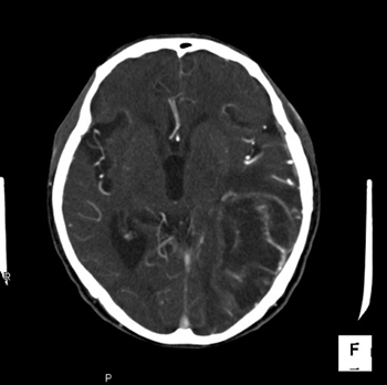 下垂体2 | Search Radiology | 医療関係者向け情報 下垂体2 | Search Radiology | 医療関係者向け情報