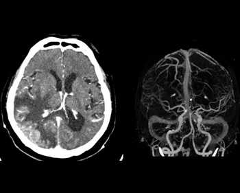 下垂体2 | Search Radiology | 医療関係者向け情報 下垂体2 | Search Radiology | 医療関係者向け情報
