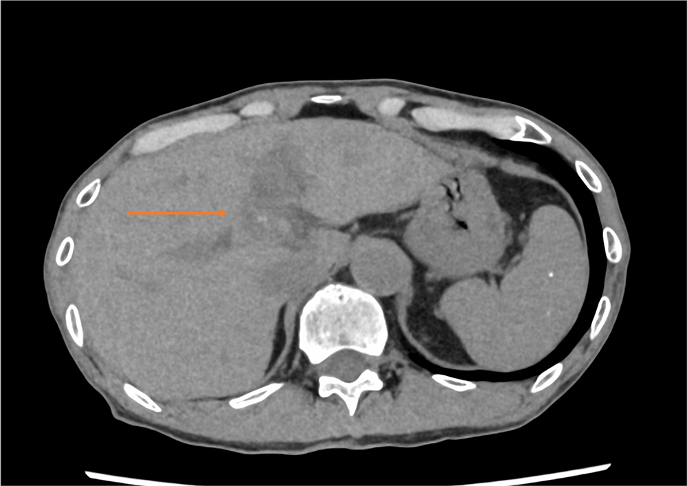 肝の画像診断 肝臓MR画像における肝区域 | 画像診断情報サイト Bayer in