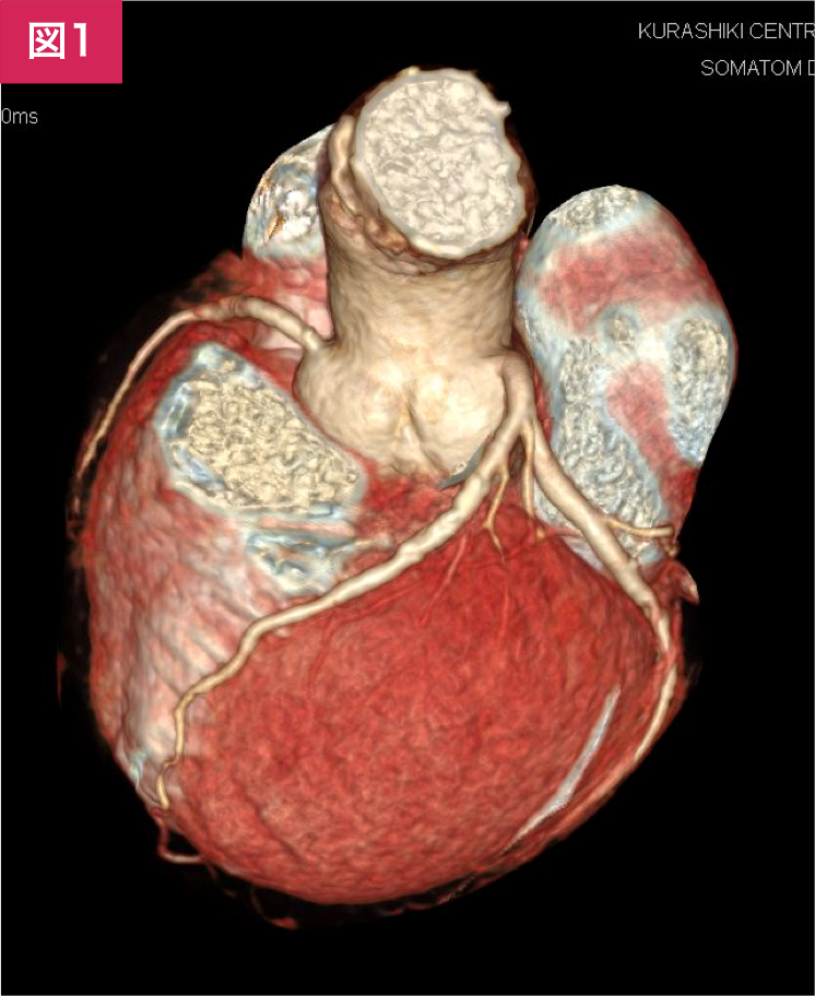 Amazon.co.jp: Coronary Intervention 11-4 : 本