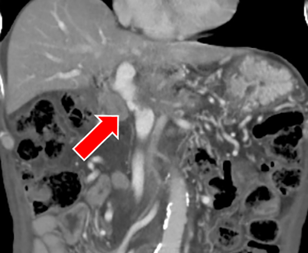 Search Radiologyー症例報告やプロトコル設定検索サイト