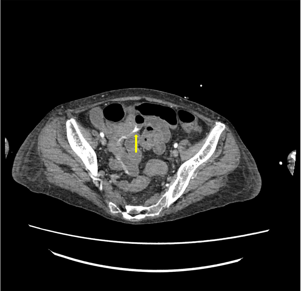 Search Radiologyー症例報告やプロトコル設定検索サイト